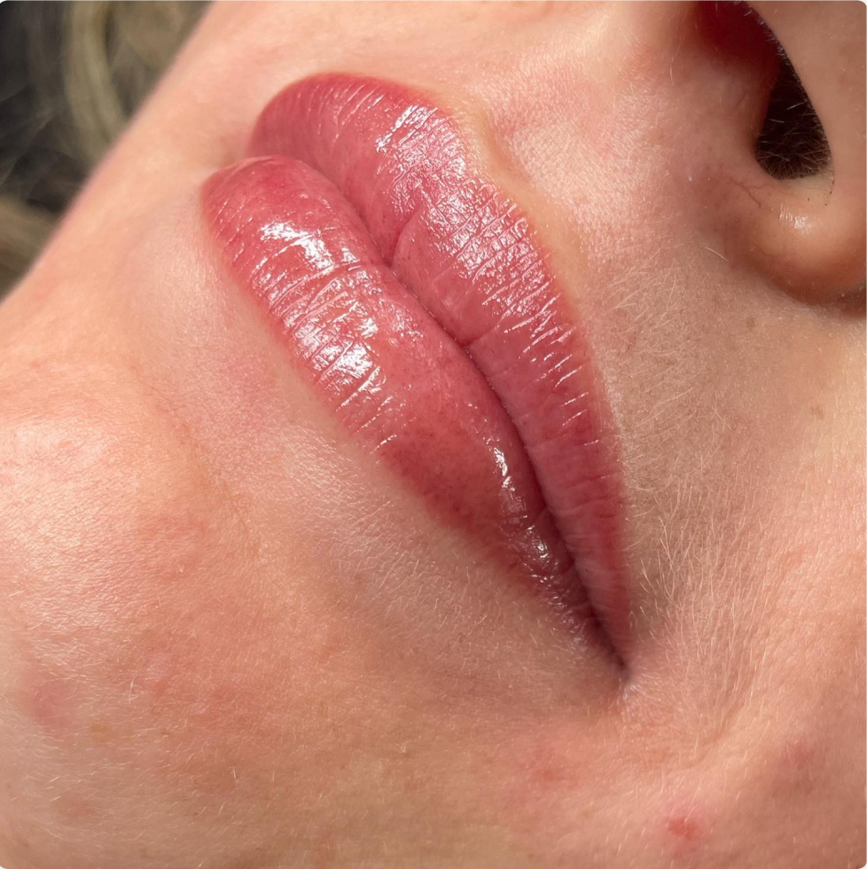 LumiLips Lips Aftercare